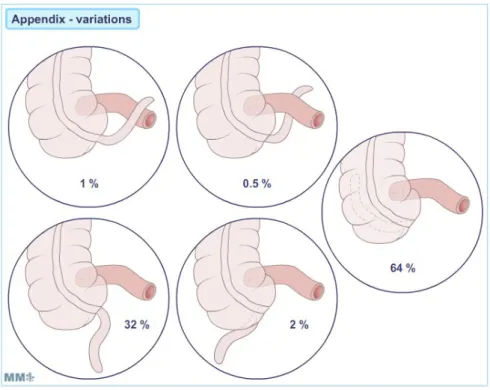 Gambar 3. Variasi anatomi posisi apendiks 12