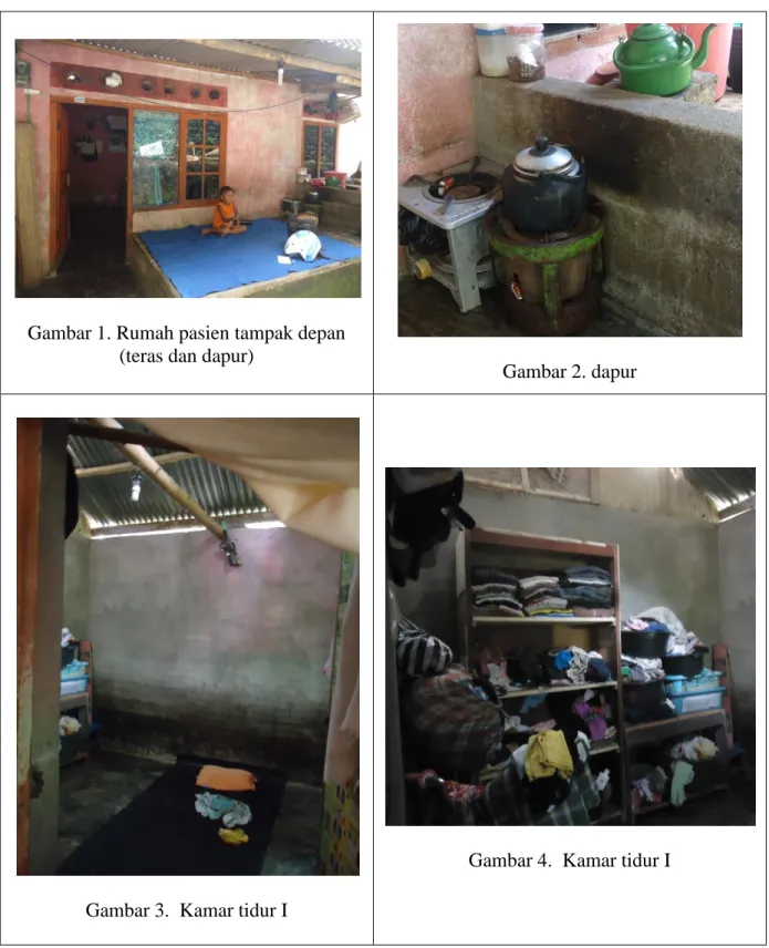 Gambar 1. Rumah pasien tampak depan  (teras dan dapur) 