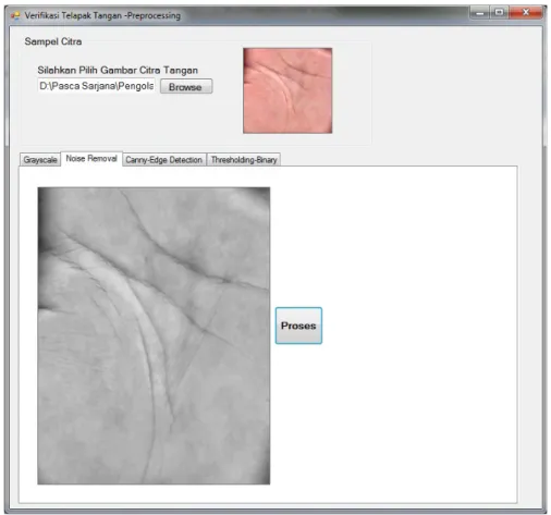 Gambar 2. 3 Proses noise removal