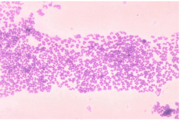 Gambar 1. Gram noda satu spesies Micrococcus, umumnya terisolasi dari  kulit dan membran hidung manusia.