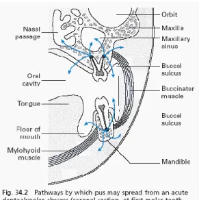 Gambar 11: Lokasi penyebaran eksudat dari infeksi gigi berdasarkan struktur disekitarnya (Topazian, 2002,  Peterson, 2003) 