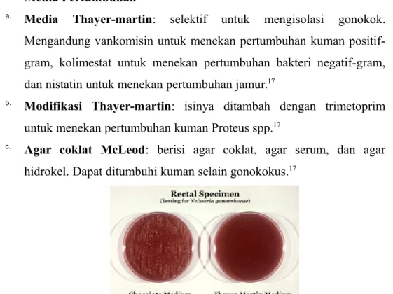 Gambar 5: Kultur pada agar coklat Mc Leod