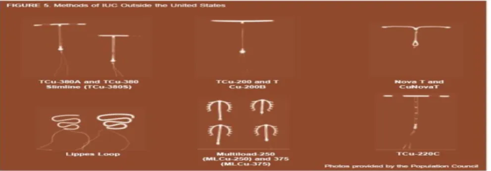 Gambar 2.1 Jenis-jenis IUD