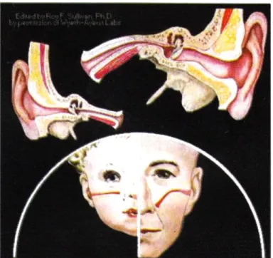 Gambar 1. Perbedaan tuba Eustachius pada anak dan dewasa. 3