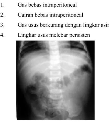 Gambar Pneumatosis Intestinal
