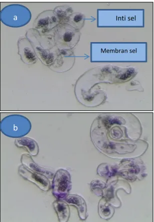 Gambar  5.  Kultur  suspensi  kalus  jeruk  purut  dengan  pewarnaan  Tripan  blue  (a)  dan  pewarnaan  Natt  &amp; 