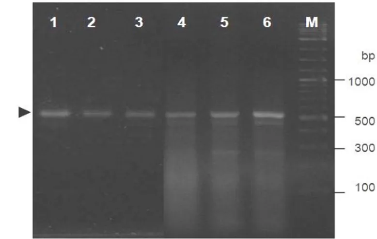 Gambar 5  Hasil elektroforesis fragmen DNA gen antivirus PmAV yang diisolasi  dari cDNA hepatopankreas udang windu P