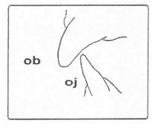 Gambar 4 : oj: overjet (jarak gigit)   ob: overbite (tumpang gigit) 