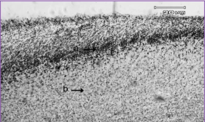 Gambar  1b.  Gambaran  histopatologis  luka  bakar  pada  kulit  tikus kelompok P2 (daun kedondong+ akuabides) hari ke-7  (a= 