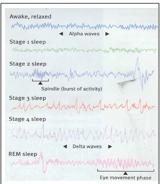 Gambar 2. Rekaman EEG Seseorang Saat Sadar sampai Tertidur  ( Fase 4 tidur dan Saat Tidur REM.) 