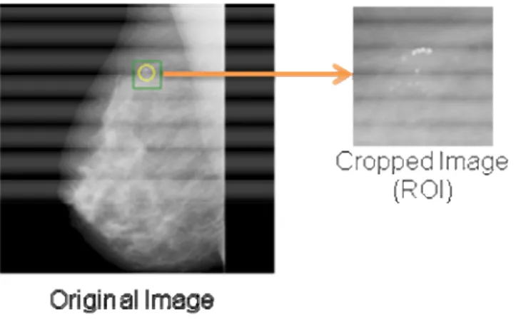 Gambar 3.3.4.1 Proses pemotongan gambar mammogram 