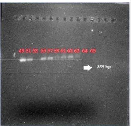 Gambar 1. Hasil optimasi suhu annealing  PCR pada suhu 49 °C hingga 65 °C