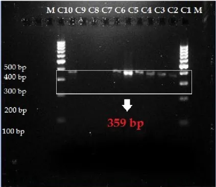 Gambar 2. Visualisasi hasil PCR dari tiap sampel soft candy, M = Marker 100 bp; 