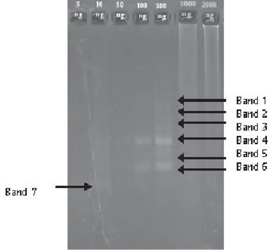Gambar 1. Hasil amplifikasi PCR berbagai konsentrasi templat DNA