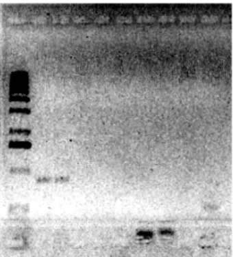 Gambar 2. Hasil amplifikasi PCR dari DNA tanaman kacang tanah putatif  transgenik (R1) dengan primer spesifik gen CP-PStV 