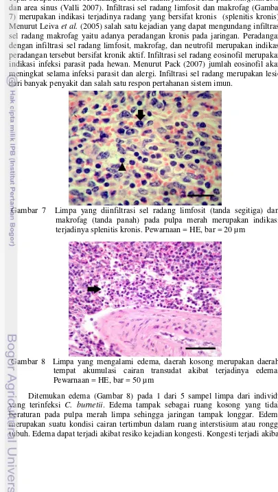 Gambar 7  Limpa yang diinfiltrasi sel radang limfosit (tanda segitiga) dan 