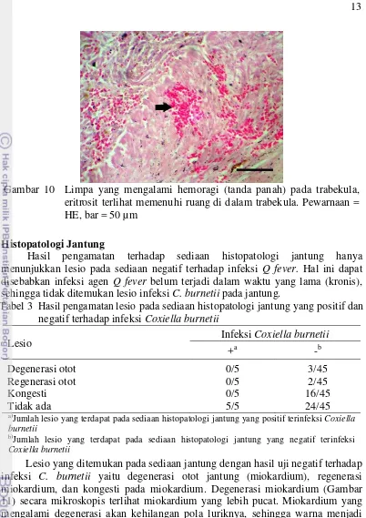 Gambar 10  Limpa yang mengalami hemoragi (tanda panah) pada trabekula, 