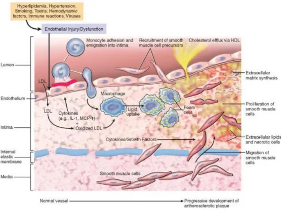 Gambar 2.2 Peranan LDL dalam proses arterosklerosis (Robbins, 2006) 