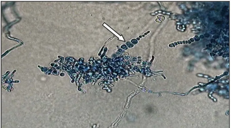 Gambar 6.  Struktur mikroskopis T. verrucosum dengan pewarnaan  Lactophenol cotton blue menunjukkan rantai klamidospora