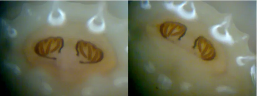 Gambar 5. Spirakel posterior larva lalat dengan mikroskop stereotype