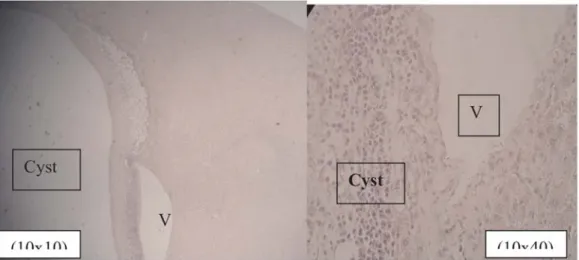 Gambar 1. Lesi Cysticercus sp. pada permukaan hati. Tampak lokasi cyst ditandai dengan adanya gelembung putih (kiri)