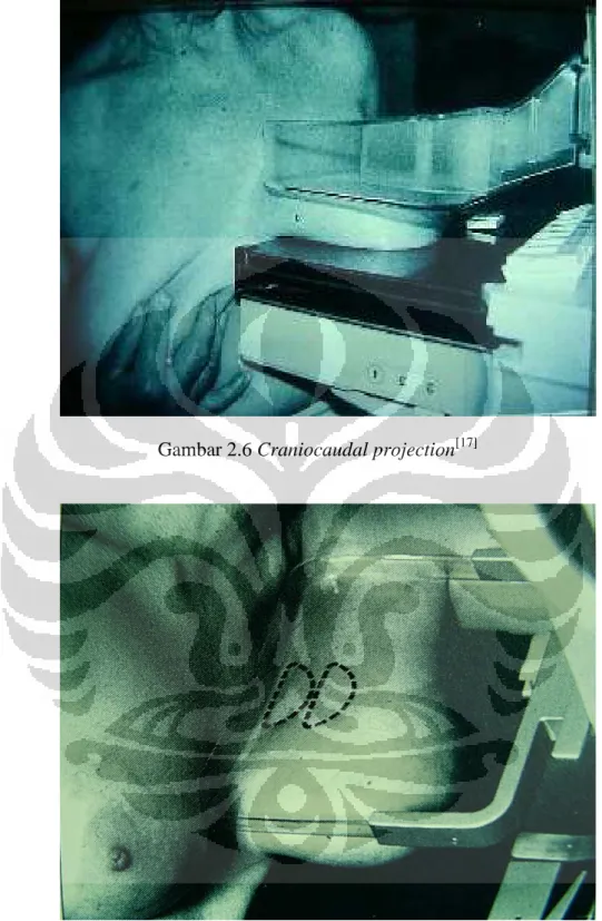 Gambar 2.6 Craniocaudal projection [17] 