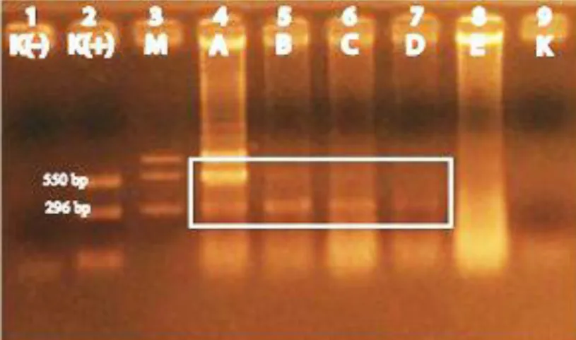 Gambar  4.  Hasil  PCR  udang  windu  dengan  kit  IQ2000 TM   WSSV;  Menunjukkan  bahwa  lane  1  kontrol  negatif,  lane 2 kontrol positif, lane 3 marker, lane 4 – 9 adalah sampel, dan didapati hasil sampel pada lane  4-7 positif terinfeksi WSSV dan lane