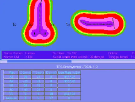 Gambar 9. Salah satu bentuk luaran hasil RCAL-1 – kurva isodosis. 