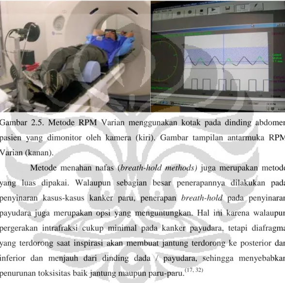 Gambar  2.5.  Metode  RPM  Varian  menggunakan  kotak  pada  dinding  abdomen  pasien  yang  dimonitor  oleh  kamera  (kiri)