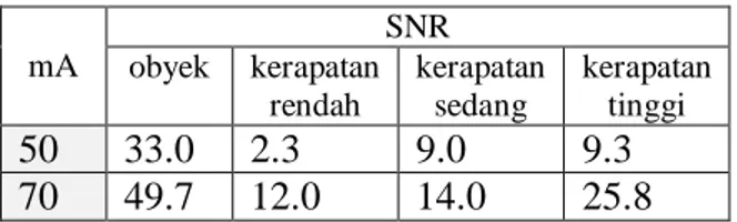 Tabel  2.  Perbandingan nilai SNR terhadap  arus filamen pada beberapa ROI. 