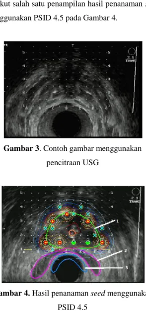 Gambar  3.  merupakan  salah  satu  contoh  pencitraan menggunakan  Ultrasonografi  (USG)  yang telah tersedia pada software PSID 4.5.