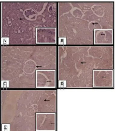 Gambar 1:  Ekspresi TNFα ginjal tikus (Rattus norvegicus) model hiperkolesterolemia  perbesaran  400X