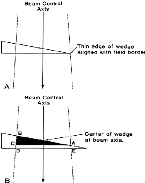 Gambar 2.8 Sistem Wedge (Khan, 1994). 