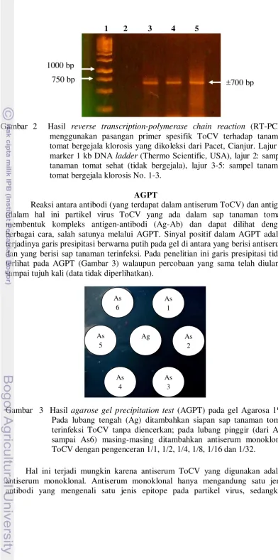 Gambar 2  Hasil reverse transcription-polymerase chain reaction (RT-PCR) 