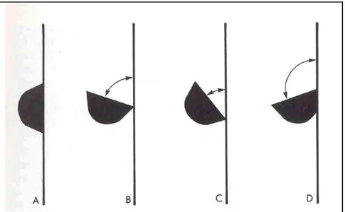 Gambar 5.  Angulasi alat. A. 0°, sudut untuk penyelipan alat ke sulkus/saku; B. 45 - 90°.,  sudut yang tepat untuk penskeleran dan penyerutan akar; C