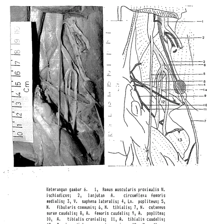 Gambar  6.  Daerah  paha  lateral,  kiri  (b). 