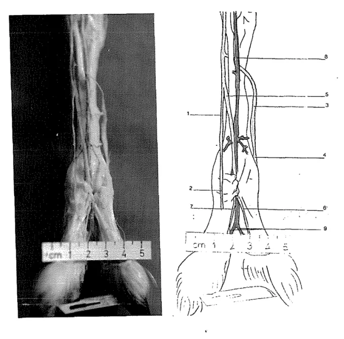 Gambar  13.  Daerah  kaki  bawah  dan  jari,  dorsal,  kanan.  Kulit  dihilangkan.  ,  