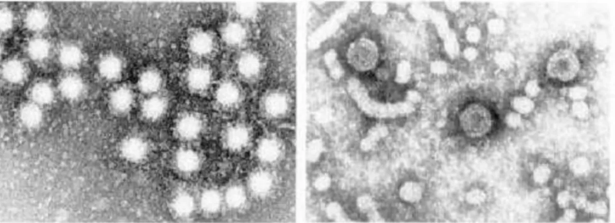 Gambar 4. Virus Hepatitis A