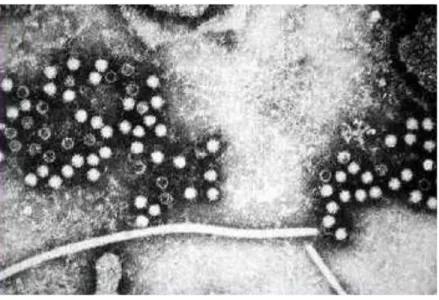 Gambar 5. Virus Hepatitis E