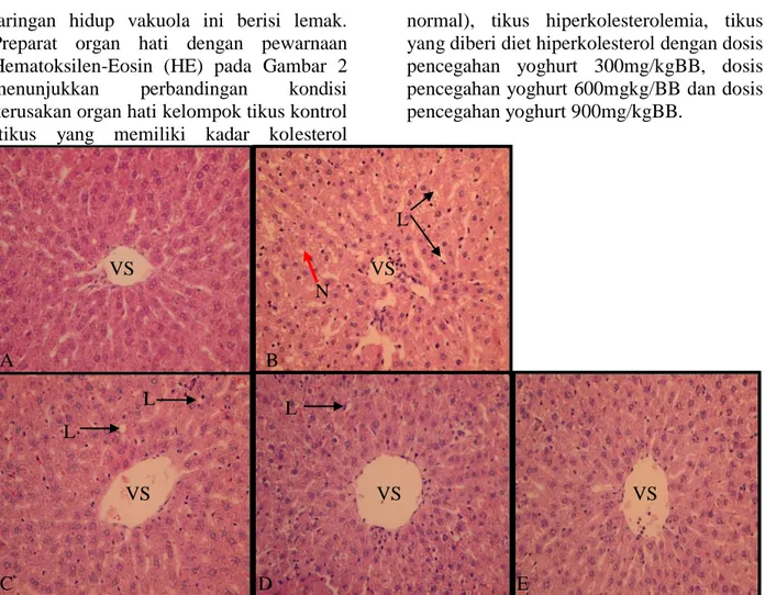 Gambar 2. Gambaran histopatologi Organ Hati tikus (HE, 400x), A. Kontrol Negatif (Normal),  B