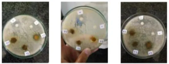 Gambar  II. Hasil Uji Antibakteri Facial Wash Gel Ekstrak Daun Kersen ( Muntingia calabura  L.) terhadap Bakteri  P.acnes 