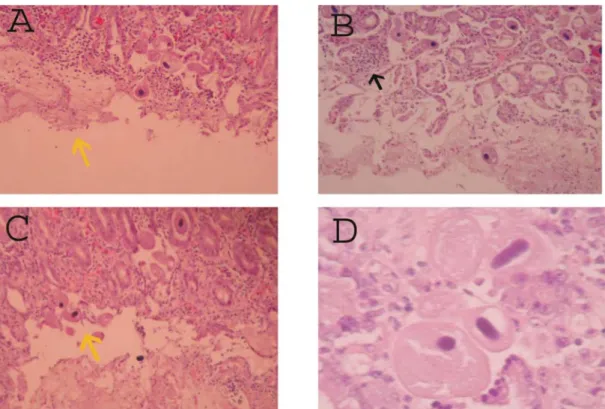 Gambar 1. Fotomikrograf jaringan kolon babi terinfeksi Balantidium  coli. A = Peradangan pseudomembranus,  B= Enteritis nekrotikan, C= Erosi, D = Protozoa stadium trophozoit dan kista dekat muskularis mukosa.