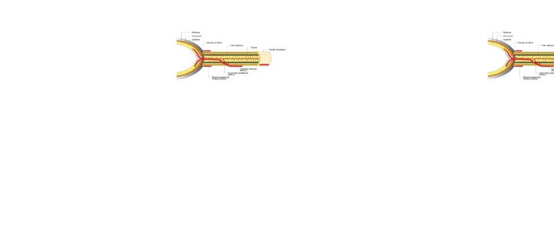 Gambar 3. Vaskularisasi nervus optikus