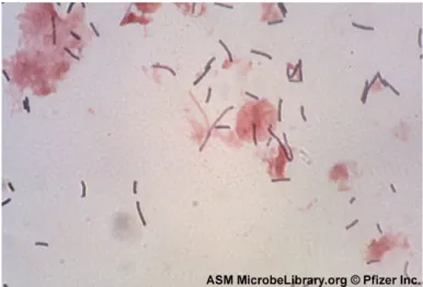 Gambar 2.3 Tampak gambaran  Lactobacillus acidophilus  menggunakan  mikroskop dengan pengecatan gram (Buxton, 2007)