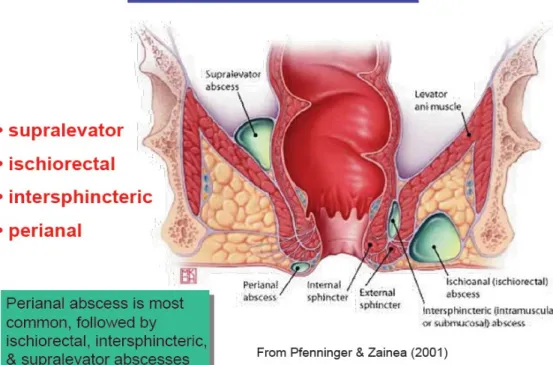 Gambar 2. Tempat terjadinya abses Anorektal C. Patofisiologi