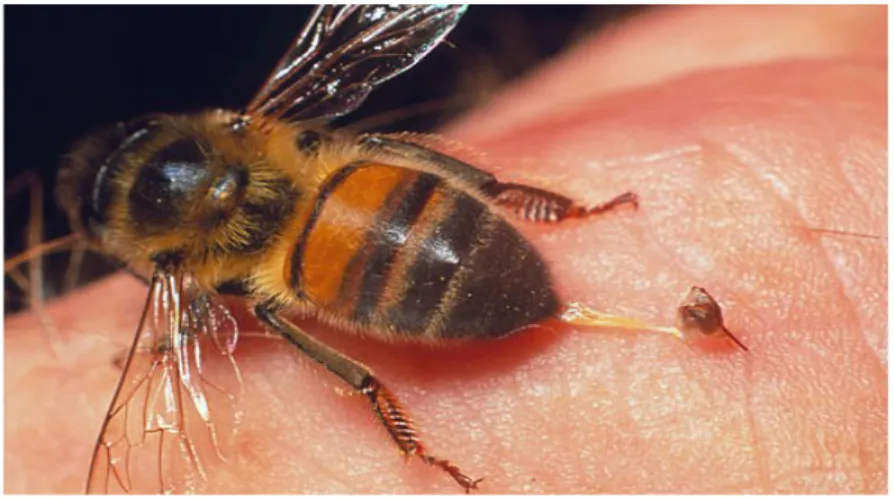 Gambar 2.1 Sengatan lebah merupakan penyebab anafilaktik  10