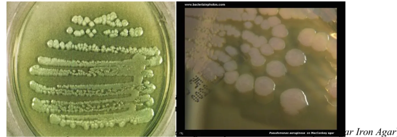 Gambar 2.5 Bakteri Pseudomonas aeruginosa pada media MC  (Bacteriainphotos, 2012)