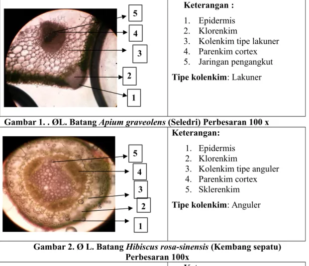 Gambar 2. Ø L. Batang Hibiscus rosa-sinensis (Kembang sepatu) Perbesaran 100x Keterangan : 1