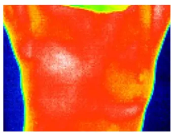 Gambar 2: Citra termografi RGB dengan format  JPG 