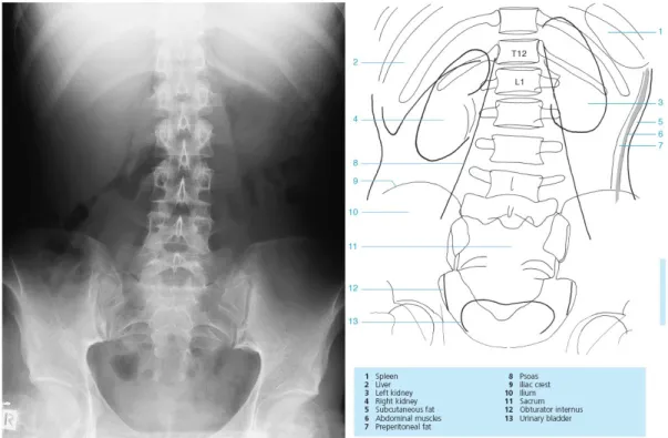 Gambar 2.6. Anatomi Radiografi Foto Polos Abdomen